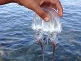 puntura medusa 4 rimedi naturali